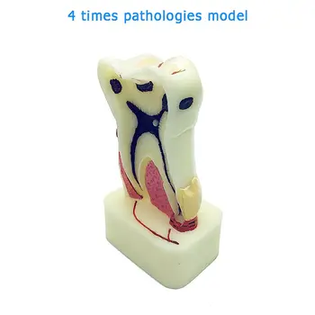 4 Vezes de Patologias Modelo Dental Dentes Modelo Dentista Estudar e Pesquisar Odontologia do Produto